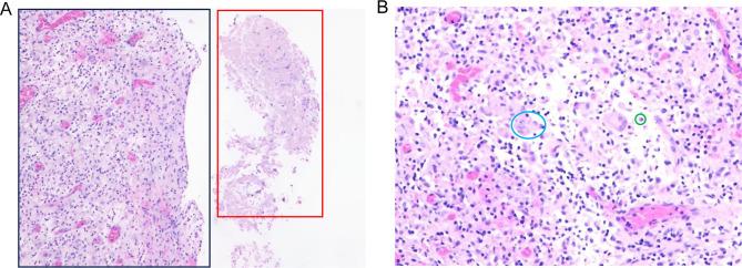 https://cdn.ncbi.nlm.nih.gov/pmc/blobs/cc57/11645288/893bd081dfd6/IDR-17-5481-g0003.jpg
