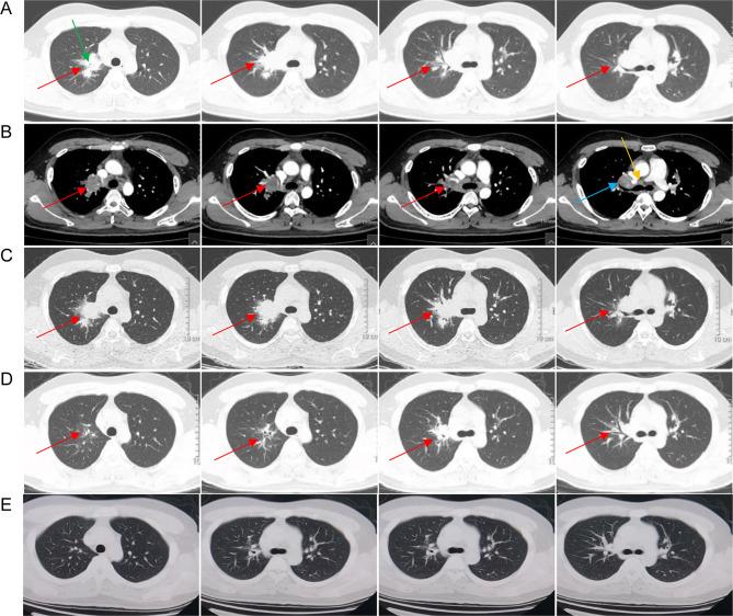 https://cdn.ncbi.nlm.nih.gov/pmc/blobs/cc57/11645288/ec6d810520bb/IDR-17-5481-g0001.jpg