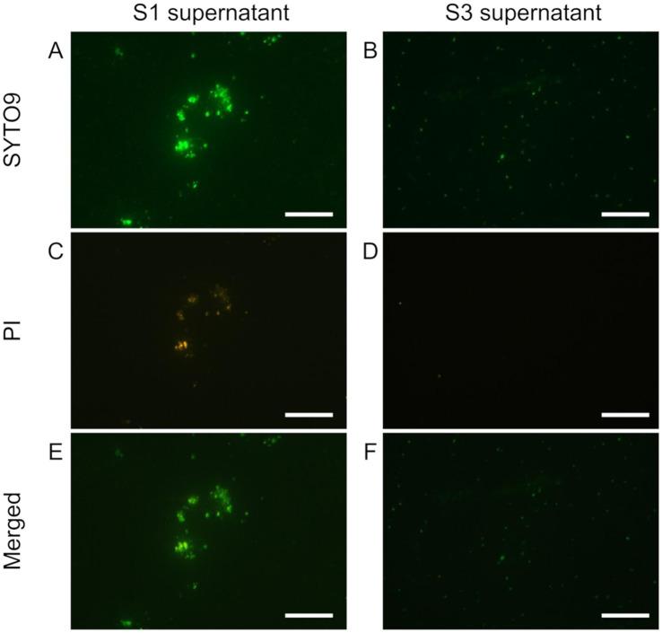 https://cdn.ncbi.nlm.nih.gov/pmc/blobs/cc5a/12010503/29a8a10fb0ac/fmicb-16-1557188-g001.jpg