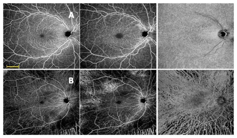 https://cdn.ncbi.nlm.nih.gov/pmc/blobs/cc5d/7167867/086c61d63f81/diagnostics-10-00050-g001.jpg