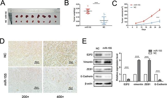https://cdn.ncbi.nlm.nih.gov/pmc/blobs/cc61/4991458/179fcd8219ac/oncotarget-07-20324-g006.jpg