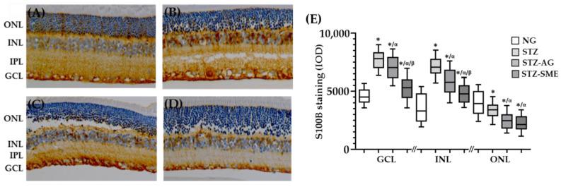 https://cdn.ncbi.nlm.nih.gov/pmc/blobs/cc62/8147642/de3b8f0e6638/antioxidants-10-00717-g005.jpg