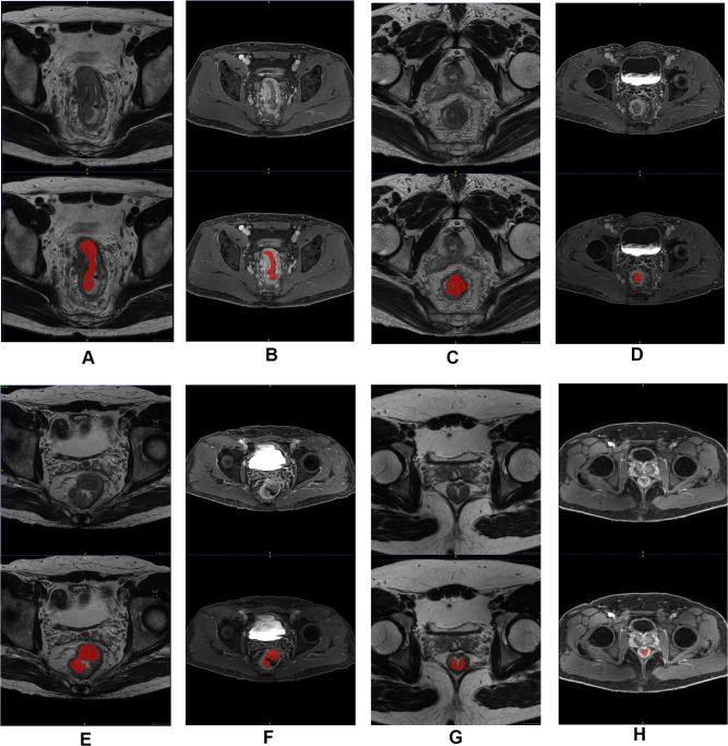https://cdn.ncbi.nlm.nih.gov/pmc/blobs/cc63/8053518/a65fdb25e13d/CMAR-13-3235-g0002.jpg