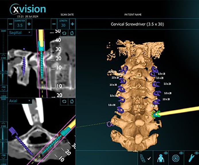 https://cdn.ncbi.nlm.nih.gov/pmc/blobs/cc65/12221874/6a081842871c/gr4.jpg