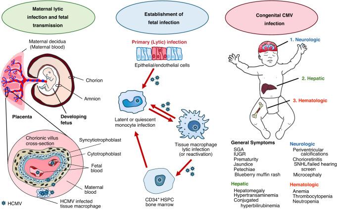https://cdn.ncbi.nlm.nih.gov/pmc/blobs/cc69/10837078/a357ed2999e9/41390_2023_2957_Fig1_HTML.jpg