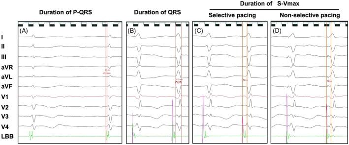 https://cdn.ncbi.nlm.nih.gov/pmc/blobs/cc71/6671779/169dca2eb92e/CLC-42-768-g002.jpg