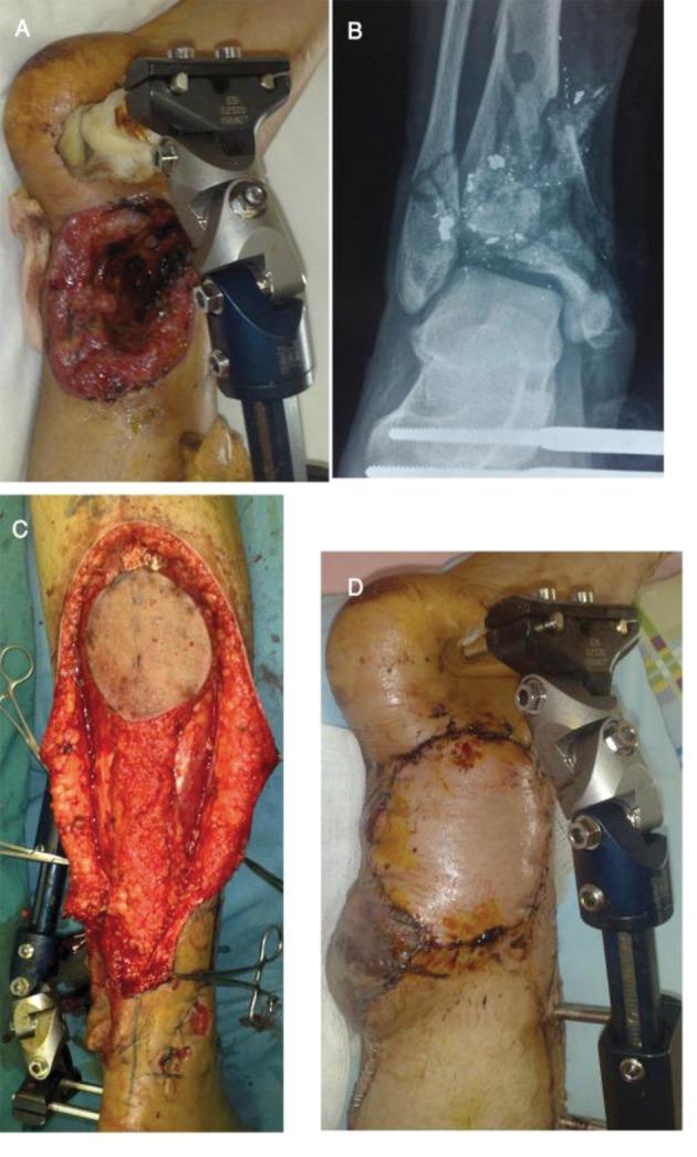 https://cdn.ncbi.nlm.nih.gov/pmc/blobs/cc86/3989569/3f8966d0950c/traumamon-16-178-g001.jpg