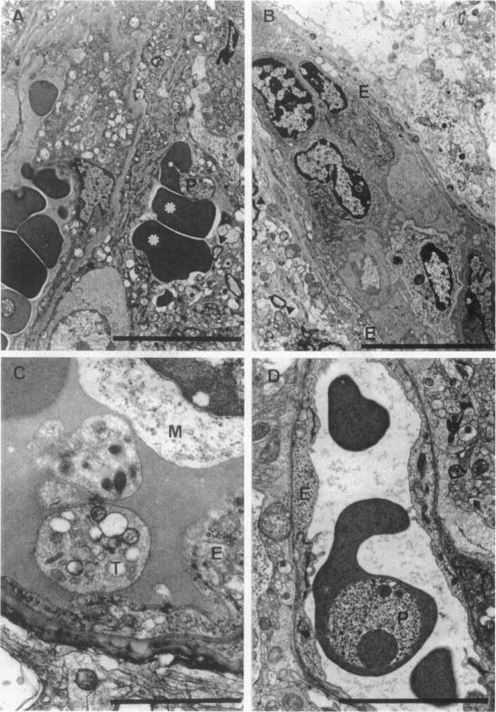 https://cdn.ncbi.nlm.nih.gov/pmc/blobs/cc8d/1858518/89966660d238/amjpathol00025-0254-a.jpg
