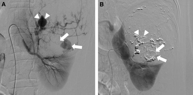 https://cdn.ncbi.nlm.nih.gov/pmc/blobs/cc8e/4996596/ce2dc97d6205/fig-2.jpg