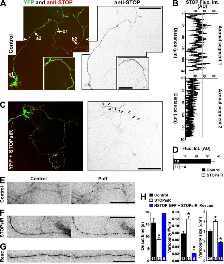 https://cdn.ncbi.nlm.nih.gov/pmc/blobs/cc8e/5496611/4d96e13a8256/JCB_201606065_Fig7.jpg