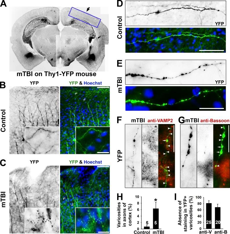https://cdn.ncbi.nlm.nih.gov/pmc/blobs/cc8e/5496611/b3f71778fb94/JCB_201606065_Fig2.jpg