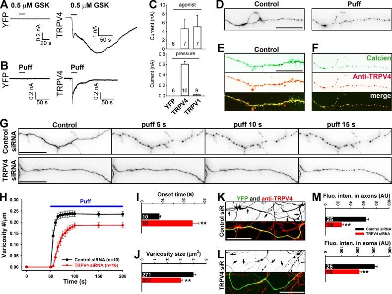 https://cdn.ncbi.nlm.nih.gov/pmc/blobs/cc8e/5496611/bbb41c947d83/JCB_201606065_Fig3.jpg