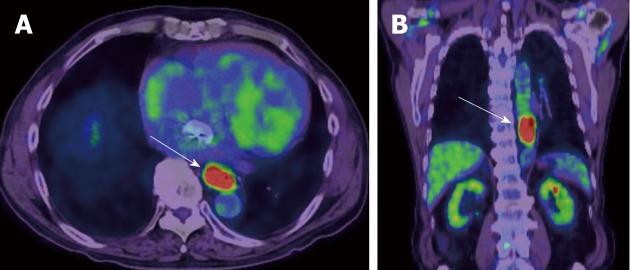 https://cdn.ncbi.nlm.nih.gov/pmc/blobs/cc8e/6603816/0841159ee1ba/WJG-25-3021-g004.jpg
