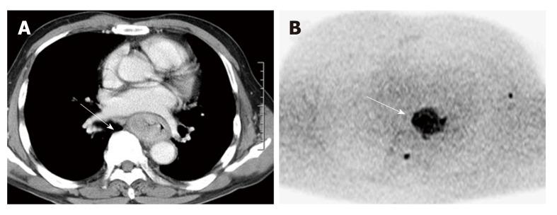 https://cdn.ncbi.nlm.nih.gov/pmc/blobs/cc8e/6603816/0db78b6109b7/WJG-25-3021-g003.jpg