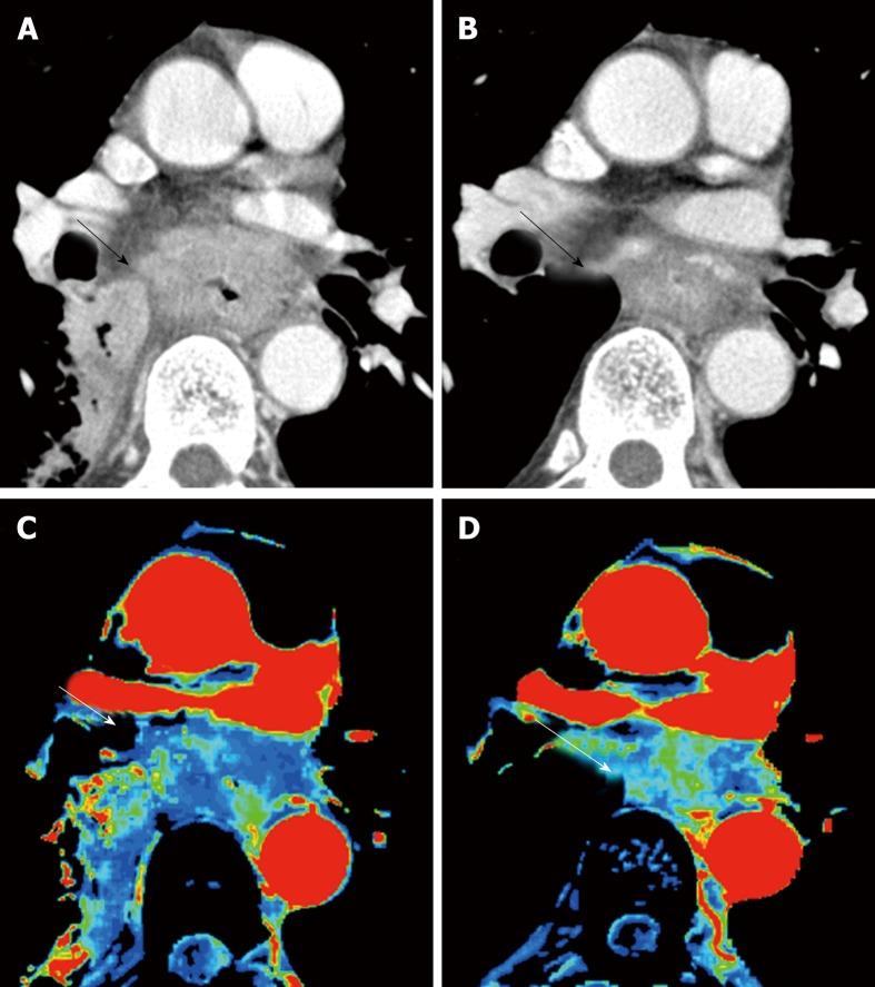 https://cdn.ncbi.nlm.nih.gov/pmc/blobs/cc8e/6603816/dacb1d436f28/WJG-25-3021-g001.jpg
