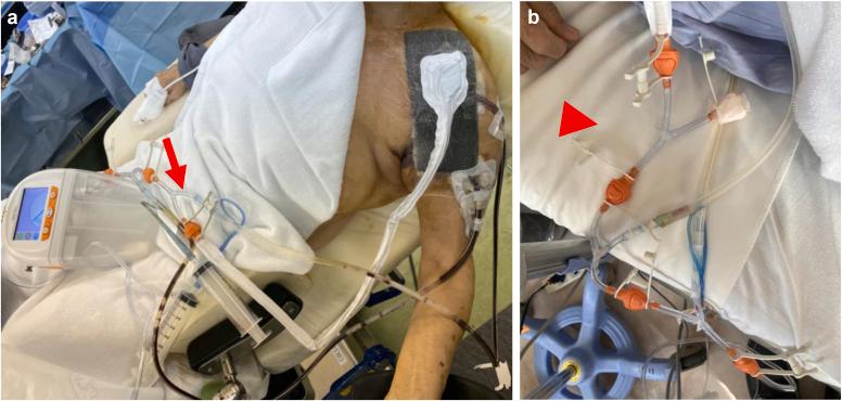https://cdn.ncbi.nlm.nih.gov/pmc/blobs/cc92/11329016/a3edd72bd478/gr3.jpg