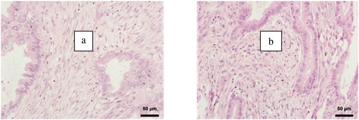https://cdn.ncbi.nlm.nih.gov/pmc/blobs/cc9b/5487255/9353edbb8067/gr1.jpg