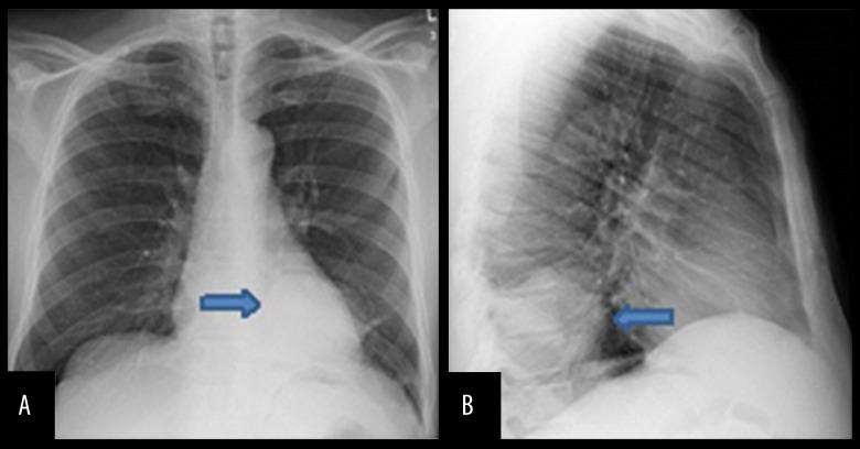 https://cdn.ncbi.nlm.nih.gov/pmc/blobs/cca4/5510997/ad6393a58823/amjcaserep-18-760-g001.jpg