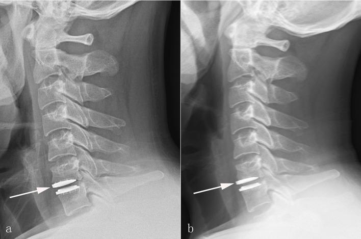 https://cdn.ncbi.nlm.nih.gov/pmc/blobs/cca9/4956276/23262ed78254/pone.0159761.g002.jpg