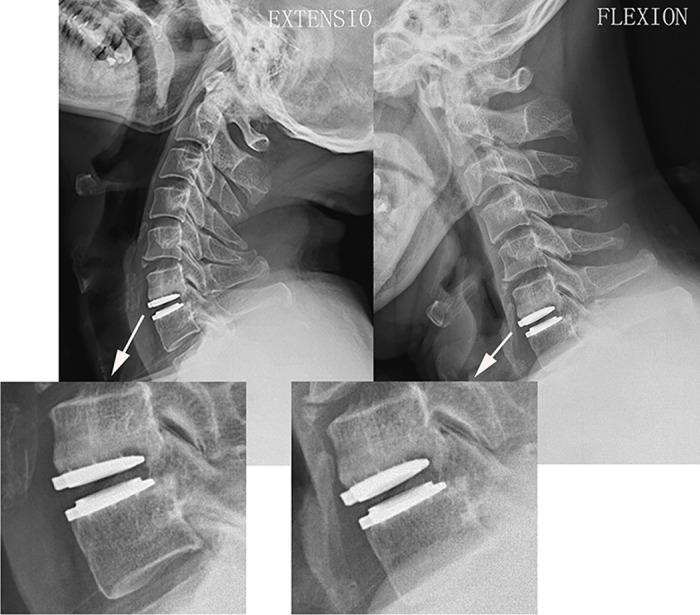 https://cdn.ncbi.nlm.nih.gov/pmc/blobs/cca9/4956276/2ad219ebaa5e/pone.0159761.g004.jpg
