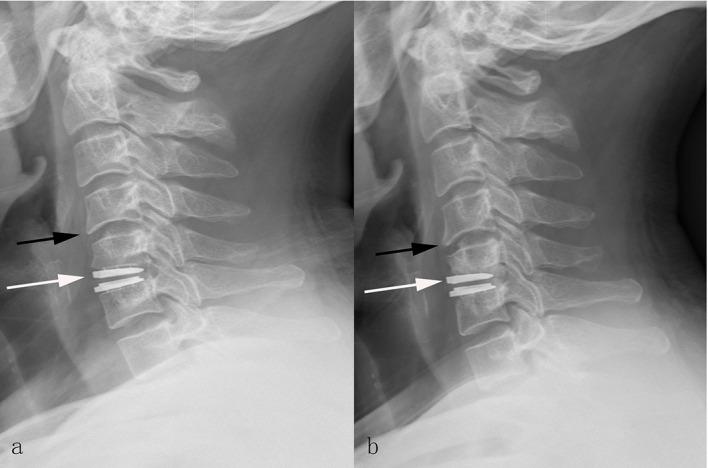 https://cdn.ncbi.nlm.nih.gov/pmc/blobs/cca9/4956276/f419ab38d74a/pone.0159761.g003.jpg
