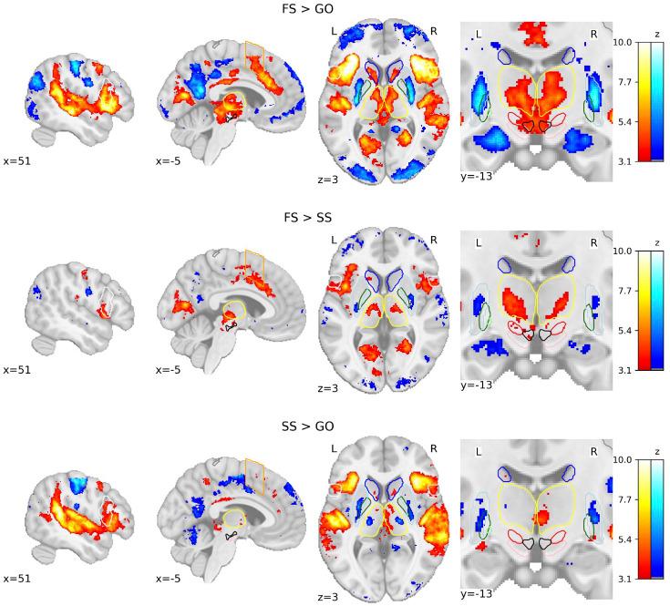 https://cdn.ncbi.nlm.nih.gov/pmc/blobs/ccad/11753779/a788c6c6fe87/elife-88652-fig2.jpg