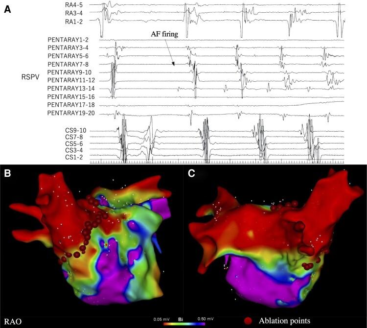 https://cdn.ncbi.nlm.nih.gov/pmc/blobs/ccad/9856327/934bafd66420/ytac481f2.jpg
