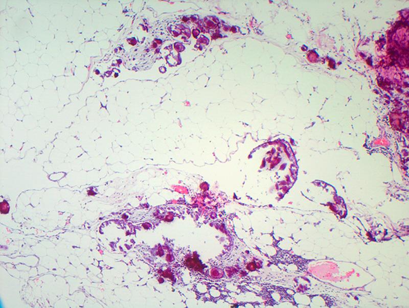 https://cdn.ncbi.nlm.nih.gov/pmc/blobs/ccae/4423656/3d9d5a76c154/pgp-34-288-g007.jpg