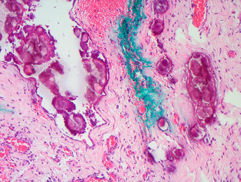 https://cdn.ncbi.nlm.nih.gov/pmc/blobs/ccae/4423656/42fc5a6a6947/pgp-34-288-g005.jpg
