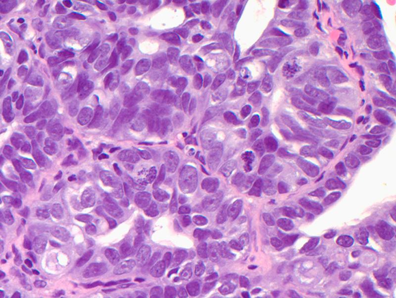 https://cdn.ncbi.nlm.nih.gov/pmc/blobs/ccae/4423656/6c1975d59067/pgp-34-288-g002.jpg