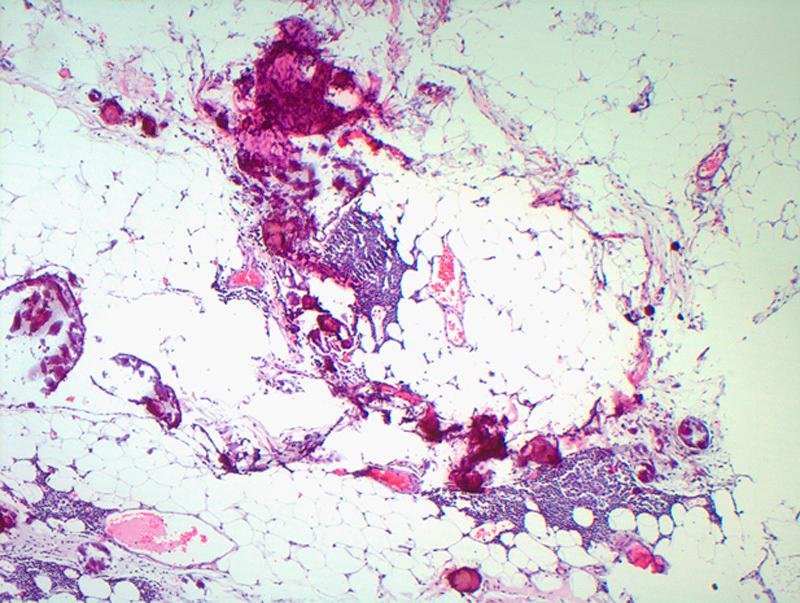 https://cdn.ncbi.nlm.nih.gov/pmc/blobs/ccae/4423656/84549a6c1bef/pgp-34-288-g008.jpg