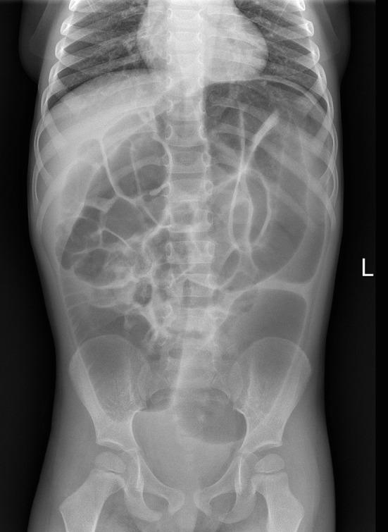 https://cdn.ncbi.nlm.nih.gov/pmc/blobs/ccb7/7890130/5d7b73bc6e45/fped-08-617309-g0002.jpg
