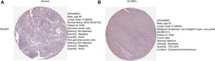 https://cdn.ncbi.nlm.nih.gov/pmc/blobs/ccb7/9902697/7b26a4c5a914/fgene-13-1092678-g010.jpg