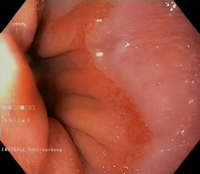 https://cdn.ncbi.nlm.nih.gov/pmc/blobs/ccb8/11729095/10d9794d9c9a/104_2024_2213_Fig4_HTML.jpg