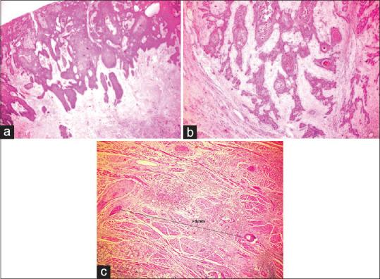 https://cdn.ncbi.nlm.nih.gov/pmc/blobs/ccbc/8083399/fbcb939e8179/JOMFP-24-587-g004.jpg