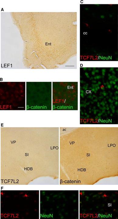 https://cdn.ncbi.nlm.nih.gov/pmc/blobs/ccc2/3825142/a9dccdcb3e3a/429_2012_474_Fig4_HTML.jpg