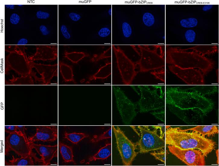 https://cdn.ncbi.nlm.nih.gov/pmc/blobs/ccc5/12018551/a6336efb864f/gr3.jpg