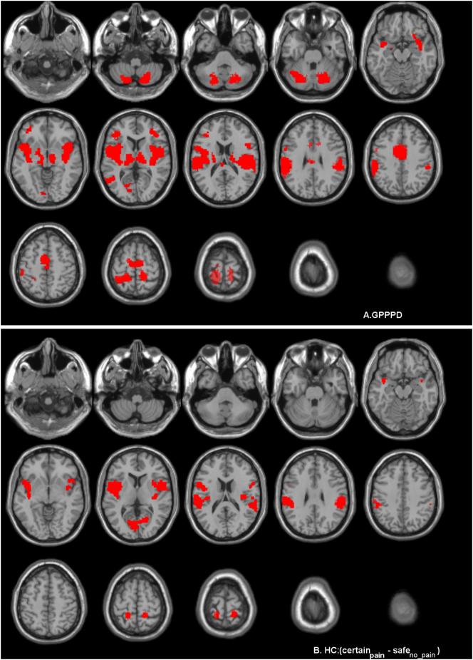 https://cdn.ncbi.nlm.nih.gov/pmc/blobs/ccc9/5596304/0ac69ec2e340/gr5ab.jpg