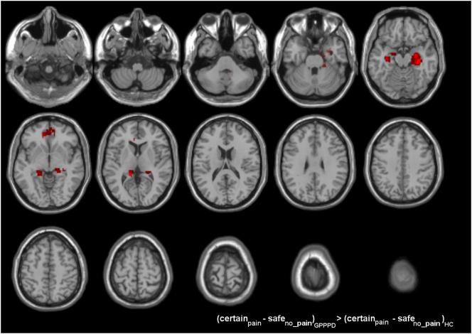 https://cdn.ncbi.nlm.nih.gov/pmc/blobs/ccc9/5596304/d84bbead2b91/gr6.jpg