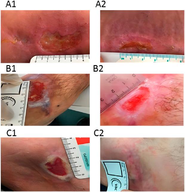 https://cdn.ncbi.nlm.nih.gov/pmc/blobs/cccb/11872921/a0fdff558b28/fbioe-13-1535588-g004.jpg