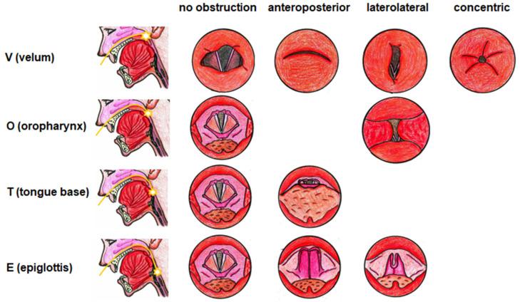 https://cdn.ncbi.nlm.nih.gov/pmc/blobs/cccf/9502758/b544d51ffc0a/life-12-01378-g002.jpg