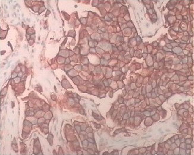 https://cdn.ncbi.nlm.nih.gov/pmc/blobs/ccd2/7779303/fa63764d0dd4/CMAR-12-13479-g0001.jpg