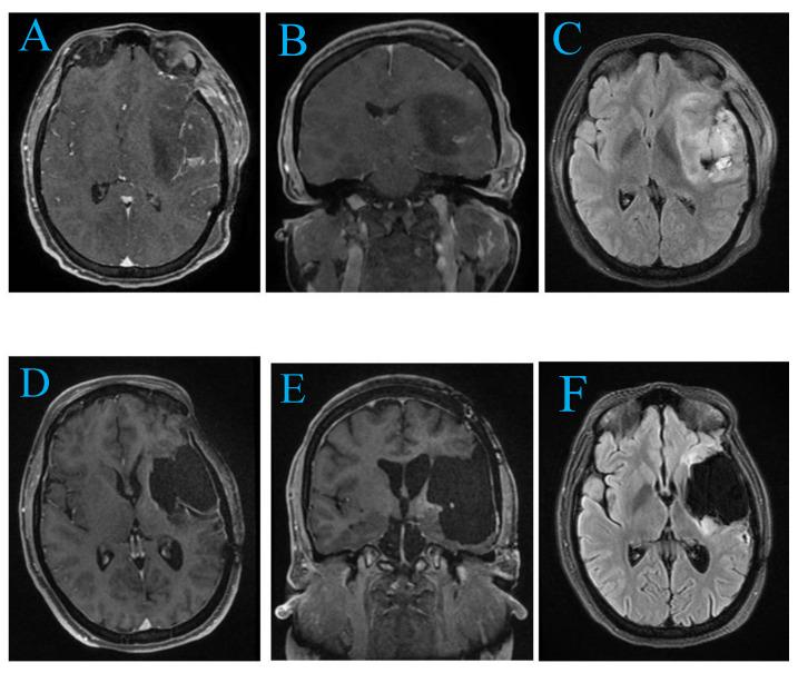 https://cdn.ncbi.nlm.nih.gov/pmc/blobs/ccdb/11764291/44d3139a9a0c/curroncol-32-00041-g002.jpg