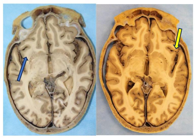 https://cdn.ncbi.nlm.nih.gov/pmc/blobs/ccdb/11764291/f6931402efb4/curroncol-32-00041-g005.jpg