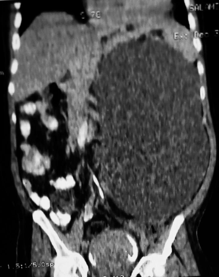 https://cdn.ncbi.nlm.nih.gov/pmc/blobs/ccdd/5986023/cd1cdc7eb417/CCR3-6-1074-g001.jpg