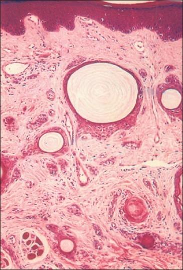 https://cdn.ncbi.nlm.nih.gov/pmc/blobs/cce2/3505290/54ca2c506f1a/IJSTD-33-124-g002.jpg