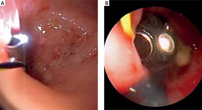 https://cdn.ncbi.nlm.nih.gov/pmc/blobs/cce5/5649491/452bca52bece/WIITM-12-29942-g003.jpg