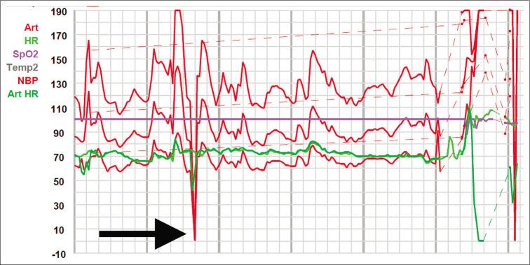 https://cdn.ncbi.nlm.nih.gov/pmc/blobs/cce8/8168658/6be2f32c4200/SNI-12-183-g003.jpg