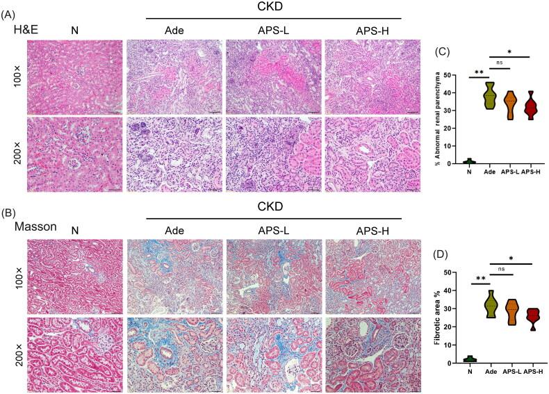 https://cdn.ncbi.nlm.nih.gov/pmc/blobs/ccea/11610254/4cd2c5ce1165/IRNF_A_2429693_F0002_C.jpg