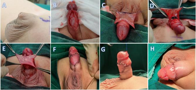https://cdn.ncbi.nlm.nih.gov/pmc/blobs/ccea/12032029/c0d75cb00232/41598_2025_99589_Fig2_HTML.jpg